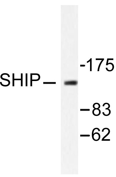 Western blot (WB) analysis of SHIP1 antibody in extracts from HuvEc cells.