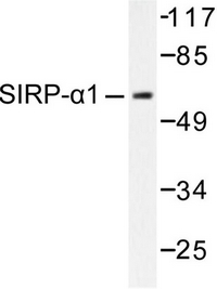 Western blot (WB) analysis of CD172a / SIRPA antibody in extracts from HepG2 cells.