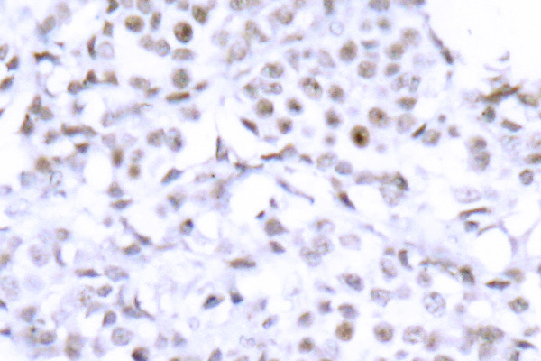 Immunohistochemistry (IHC) analysis of SMC1 antibody in paraffin-embedded human brain tissue.