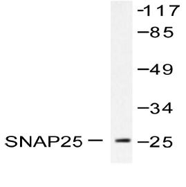 Western blot analysis of SNAP25 antibody in extracts from RAW264.7 cells treated with EGF 200ng/ml 30.