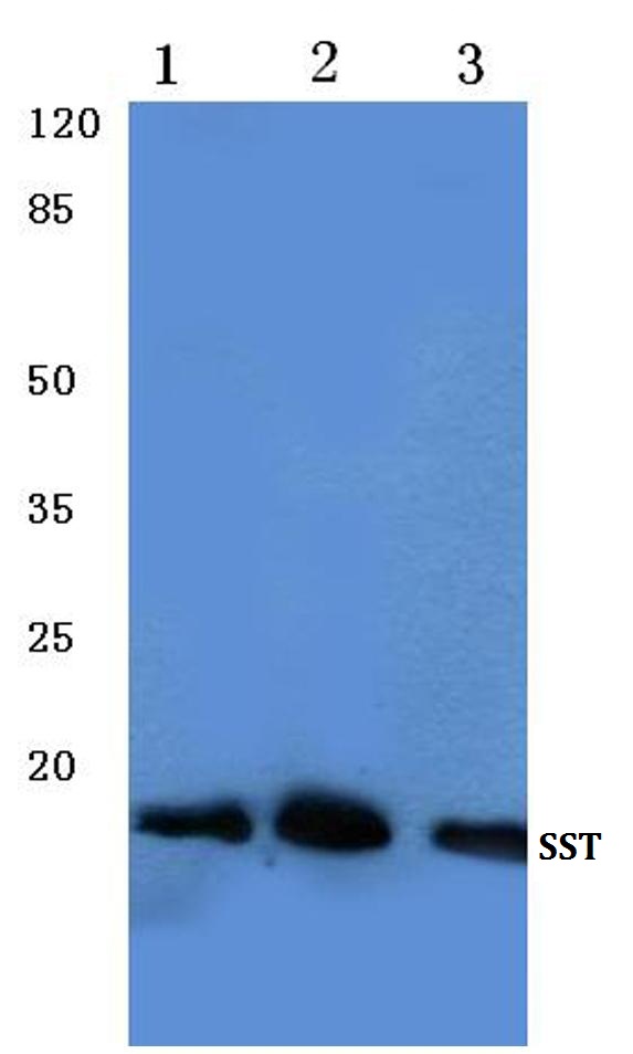 Western blot (WB) analysis of Somatostatin antibody at 1/500 dilution Lane 1:HepG2 whole cell lysate Lane 2:Mouse lung tissue lysate Lane 3:NIH-3T3 whole cell lysate