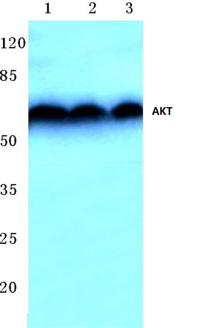 Western blot (WB) analysis of AKT antibody at 1/500 dilution Lane 1:Mouse brain tissue lysate Lane 2:NIH-3T3 whole cell lysate Lane 3:Rat brain tissue lysate