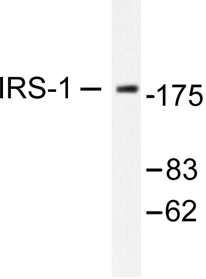 Western blot (WB) analysis of IRS-1 antibody in extracts from A431 or 293 cell treated with UV 30.