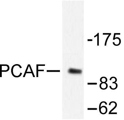 Western blot (WB) analysis of PCAF antibody in extracts from COLO205 cells.