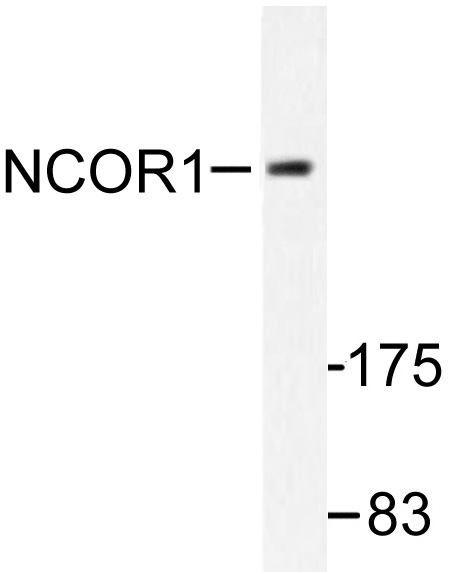 Western blot (WB) analysis of NCoR1 antibody in extracts from MDA-MB-435 cells.