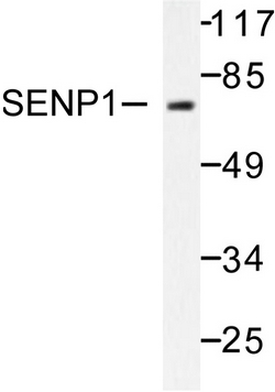 CEP70 Antibody (Center) western blot analysis in WiDr, CHO, A549, U251 cell line lysates (35ug/lane).This demonstrates the CEP70 antibody detected the CEP70 protein (arrow).