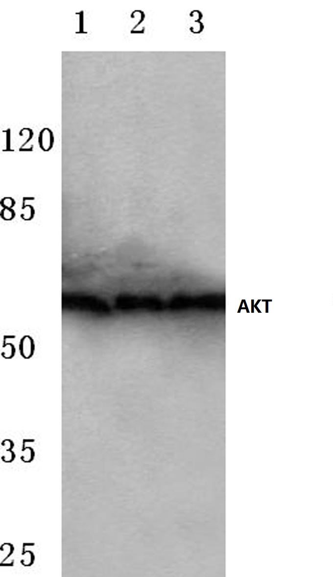 Western blot (WB) analysis of AKT antibody at 1/500 dilution Lane 1:MCF-7 whole cell lysate Lane 2:NIH-3T3 whole cell lysate Lane 3:Mouse spleen tissue lysate