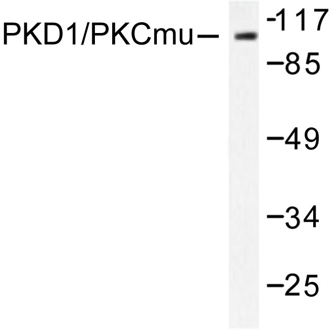 Western blot (WB) analysis of PKD1/PKC u antibody in extracts from Jurkat cells.