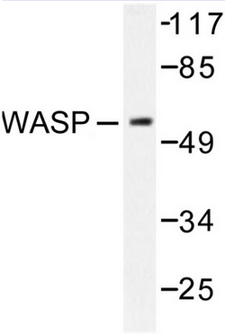 Western blot analysis of WASP antibody in extracts from HepG2 cells.