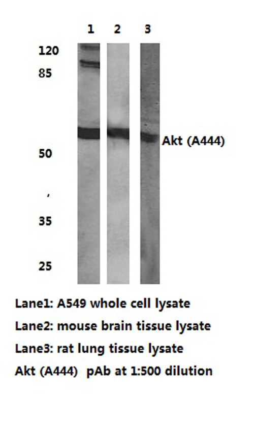 Western blot (WB) analysis of AKT antibody