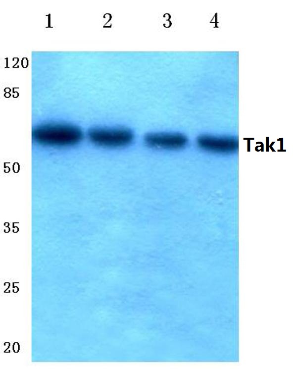 Western blot (WB) analysis of Tak1 antibody at 1/500 dilution Lane 1: Hela whole cell lysate Lane 2: MCF-7 whole cell lysate Lane 3: Mouse liver tissue lysate Lane 4: Rat liver tissue lysate