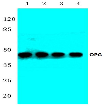 Western blot analysis of OPG antibody at 1/500 dilution Lane 1: HeLa whole cell lysate Lane 2: Mouse brain tissue lysate Lane 3: PC12 whole cell lysate Lane 4: Rat brain tissue lysate