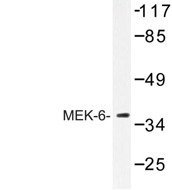 Western blot (WB) analysis of MEK-6 antibody in extracts from 293 cells.