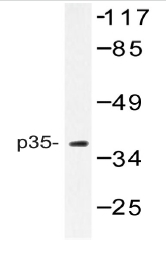 Western blot (WB) analysis of p35 antibody in extracts from Rat brain.