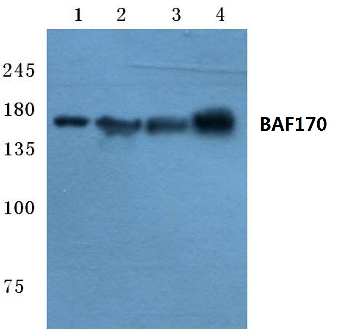 Western blot (WB) analysis of BAF170 antibody at 1/500 dilution Lane 1:HEK293T whole cell lysate Lane 2:Mouse liver tissue lysate Lane 3:Rat liver tissue lysate Lane 4:MCF-7 whole cell lysate