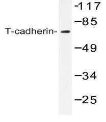 Western blot analysis of T-Cadherin antibody in extracts from LOVO cells.