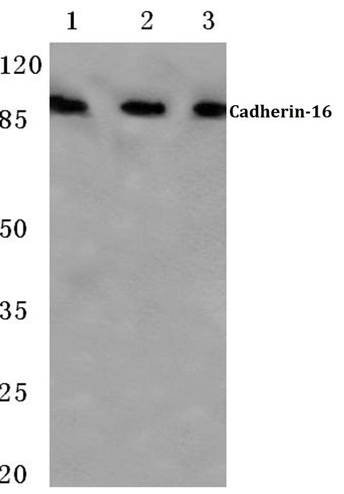 Western blot (WB) analysis of Cadherin-16 antibody at 1/500 dilution Lane 1: HEK293T whole cell lysate Lane 2: Mouse liver tissue lysate Lane 3: Rat kidney tissue lysate