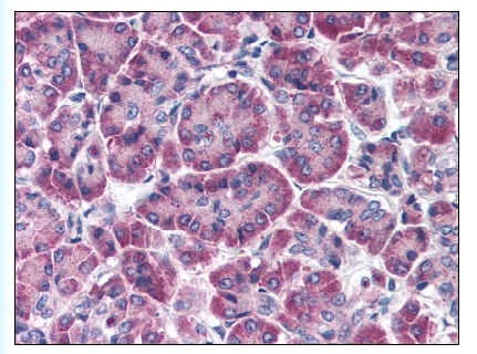 Figure 1. Formalin-Fixed Paraffin-Embedded (FFPE) on Pancreas.