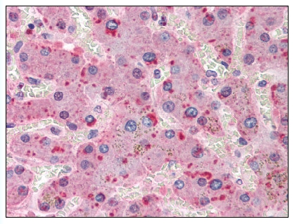 Figure 1. Formalin-Fixed Paraffin-Embedded (FFPE) on Liver.