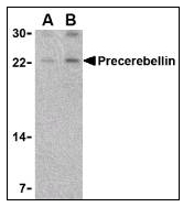 Western blot analysis of Precerebellin in Mouse cerebellum lysate with at (A) 2 and (B) 4 ug/ml.
