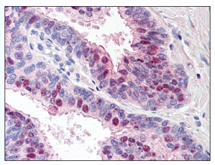 Figure 1. Formalin-Fixed Paraffin-Embedded (FFPE) on Prostate.
