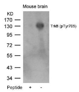 Western blot analysis in mouse kidney tissue lysates (35ug/lane) using Fidgetin antibody. This demonstrates the FIGN antibody detected the FIGN protein (arrow).