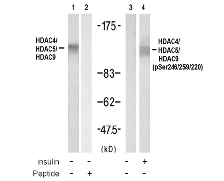 Figure 2. Western blot analysis of extracts from 3T3 cell using HDAC4/HDAC5/HDAC9 Antibody AP08090PU (Lane 1 and 2) and HDAC4/HDAC5/HDAC9 (phospho-Ser246/259/220) Antibody AP08035PU (Lane 3 and 4). Figure 2. Western blot analysis of extracts from 3T3 cell using HDAC4/HDAC5/HDAC9 Antibody AP08090PU (Lane 1 and 2) and HDAC4/HDAC5/HDAC9 (phospho-Ser246/259/220) Antibody AP08035PU (Lane 3 and 4).