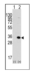 Western blot analysis of MBD3 (arrow) using rabbit polyclonal MBD3 Antibody (C-term). 293 cell lysates (2 ug/lane) either nontransfected (Lane 1) or transiently transfected with the MBD3 gene (Lane 2) (Origene Technologies).