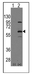 Western blot analysis of ELP3 (arrow) using rabbit polyclonal ELP3 Antibody (N-term). 293 cell lysates (2 ug/lane) either nontransfected (Lane 1) or transiently transfected with the ELP3 gene (Lane 2) (Origene Technologies).