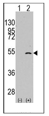 Western blot analysis of ELP3 (arrow) using rabbit polyclonal ELP3 Antibody (C-term). 293 cell lysates (2 ug/lane) either nontransfected (Lane 1) or transiently transfected with the ELP3 gene (Lane 2) (Origene Technologies).