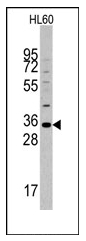 Western blot analysis of mouse MOGT2 Antibody (C-term) in HL60 cell line lysates (35ug/lane). MOGT2 (arrow) was detected using the purified Pab (1:60 dilution).