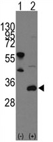 Western blot analysis of FRAT1 (arrow) using rabbit polyclonal FRAT1 Antibody (C-term). 293 cell lysates (2 ug/lane) either nontransfected (Lane 1) or transiently transfected with the FRAT1 gene (Lane 2) (Origene Technologies).