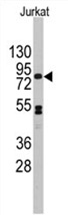 Western blot analysis of anti-CDH12 Antibody (N-term) in Jurkat cell line lysates (35 ug/lane). CDH12 (arrow) was detected using the purified Pab (1:60 dilution).