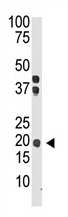 The anti-IL28 (Center) is used in Western blot to detect IL28 in mouse brain tissue lysate.