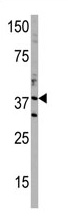 Western blot analysis of anti-DIMT1 in T47D cell line lysate (35 ug/lane). DIMT1 (arrow) was detected using the purified Pab (1:60 dilution).