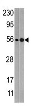Western blot analysis of anti-NMD3 in mouse heart (left) and T47D (right)tissue lysates (35 ug/lane). NMD3 (arrow) was detected using the purified Pab (1:60 dilution).