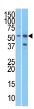 The anti-RMP is used in Western blot to detect RMP in T47D (left) and Jurkat (right) cell line lysates.