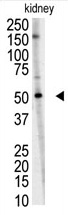 The anti-UBCE7IP1 is used in Western blot to detect UBCE7IP1 in mouse kidney tissue lysate.