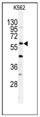 Western blot analysis of anti-USP2 Antibody (C-term) in K562 cell line lysates (35ug/lane). USP2 (arrow) was detected using the purified Pab.