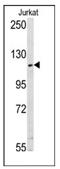 Western blot analysis of anti-USP11 Pab in Jurkat cell line lysates (35ug/lane). USP11 (arrow) was detected using the purified Pab (1:60 dilution).