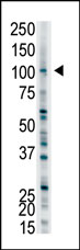 Western blot analysis of RILPL2 Antibody (Center) in WiDr cell line lysates (35ug/lane). This demonstrates the RILPL2 antibody detected the RILPL2 protein (arrow).