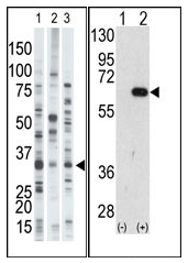 Western blot analysis of RNF185 Antibody in CHO cell line lysates (35ug/lane).This demonstrates the RN185 antibody detected the RN185 protein (arrow).