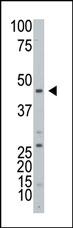 Western blot analysis of ART3 Antibody (C-term) in HL60 cell line lysates (25ug/lane). ART3 (arrow) was detected using the purified Pab (4 ug/ml).