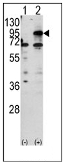 Western blot analysis of CPT1B (arrow) using rabbit polyclonal CPT1B Antibody (C-term). 293 cell lysates (2 ug/lane) either nontransfected (Lane 1) or transiently transfected with the CPT1B gene (Lane 2).