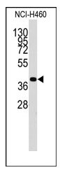 Western blot analysis of SEC14L2 Antibody (N-term) in Mouse liver tissue lysates (35ug/lane). This demonstrates the SEC14L2 antibody detected the SEC14L2 protein (arrow).