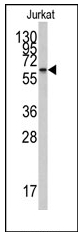 Western blot analysis of SEPT5 Antibody (N-term) in HepG2 cell line lysates (35ug/lane). This demonstrates the SEPT5 antibody detected the SEPT5 protein (arrow).