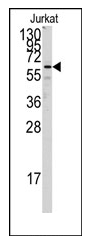 Western blot analysis of SEPT8 Antibody (C-term) in K562 cell line lysates (35ug/lane).This demonstrates the SEPT8 antibody detected the SEPT8 protein (arrow).