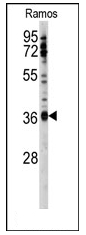 Western blot analysis using SFTPC Antibody (N-term) in Mouse liver tissue lysates (35ug/lane). This demonstrates the SFTPC antibody detected the SFTPC protein (arrow).