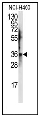 Western blot analysis of anti-JTV1 Antibody (Center) in NCI-H460 cell line lysates (35ug/lane).JTV1 (arrow) was detected using the purified Pab.