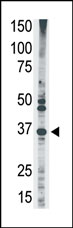 The anti-MAGEA2 N-term Antibody is used in Western blot to detect MAGEA2 in HL60 lysate.